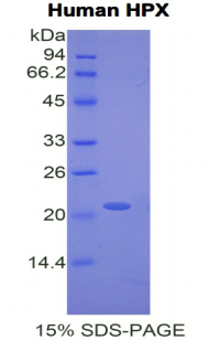 HPX / Hemopexin Protein - Recombinant Hemopexin By SDS-PAGE