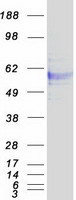 HPX / Hemopexin Protein - Purified recombinant protein HPX was analyzed by SDS-PAGE gel and Coomassie Blue Staining