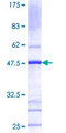 HR6B / UBE2B Protein - 12.5% SDS-PAGE of human UBE2B stained with Coomassie Blue