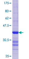 HR6B / UBE2B Protein - 12.5% SDS-PAGE Stained with Coomassie Blue.