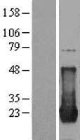 HRAS / H-Ras Protein - Western validation with an anti-DDK antibody * L: Control HEK293 lysate R: Over-expression lysate