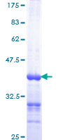HRAS / H-Ras Protein - 12.5% SDS-PAGE Stained with Coomassie Blue.