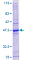 HRASLS1 / HRASLS Protein - 12.5% SDS-PAGE of human HRASLS stained with Coomassie Blue
