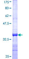 HRASLS1 / HRASLS Protein - 12.5% SDS-PAGE Stained with Coomassie Blue