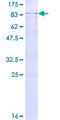 HRG Protein - 12.5% SDS-PAGE of human HRG stained with Coomassie Blue
