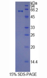 HRG Protein - Recombinant Histidine Rich Glycoprotein By SDS-PAGE