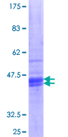 HRH1 / Histamine H1 Receptor Protein - 12.5% SDS-PAGE Stained with Coomassie Blue.