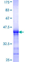 HRH3 / Histamine 3 Receptor Protein - 12.5% SDS-PAGE Stained with Coomassie Blue.