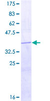 HRH4 / Histamine H4 Receptor Protein - 12.5% SDS-PAGE Stained with Coomassie Blue.