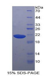 HRNR / Hornerin Protein - Recombinant Hornerin By SDS-PAGE