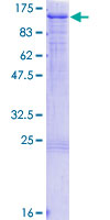 HRS / HGS Protein - 12.5% SDS-PAGE of human HGS stained with Coomassie Blue