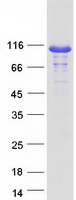 HRS / HGS Protein - Purified recombinant protein HGS was analyzed by SDS-PAGE gel and Coomassie Blue Staining