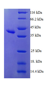 HRSP12 / UK114 Protein