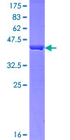 HRSP12 / UK114 Protein - 12.5% SDS-PAGE of human HRSP12 stained with Coomassie Blue
