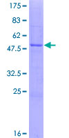 HS2ST1 Protein - 12.5% SDS-PAGE of human HS2ST1 stained with Coomassie Blue