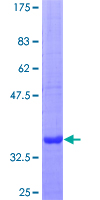HS2ST1 Protein - 12.5% SDS-PAGE Stained with Coomassie Blue.