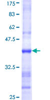 HS3ST2 Protein - 12.5% SDS-PAGE Stained with Coomassie Blue.