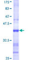 HS3ST2 Protein - 12.5% SDS-PAGE Stained with Coomassie Blue.