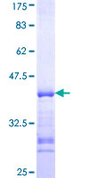 HS6ST1 Protein - 12.5% SDS-PAGE Stained with Coomassie Blue.
