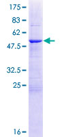 HSCB Protein - 12.5% SDS-PAGE of human HSCB stained with Coomassie Blue