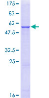 HSD11B1 / HSD11B Protein - 12.5% SDS-PAGE of human HSD11B1 stained with Coomassie Blue
