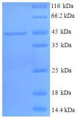HSD11B1 / HSD11B Protein