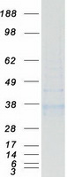 HSD11B1 / HSD11B Protein - Purified recombinant protein HSD11B1 was analyzed by SDS-PAGE gel and Coomassie Blue Staining