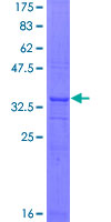 HSD17 / HSD17B1 Protein - 12.5% SDS-PAGE Stained with Coomassie Blue.