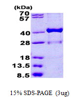 HSD17 / HSD17B1 Protein