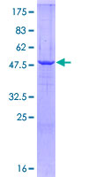 HSD17B10 / HADH2 Protein - 12.5% SDS-PAGE of human HSD17B10 stained with Coomassie Blue