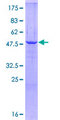 HSD17B10 / HADH2 Protein - 12.5% SDS-PAGE of human HSD17B10 stained with Coomassie Blue
