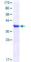 HSD17B10 / HADH2 Protein - 12.5% SDS-PAGE Stained with Coomassie Blue.