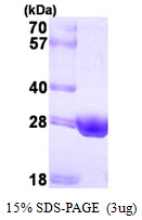 HSD17B10 / HADH2 Protein