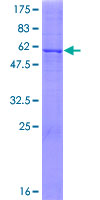 HSD17B11 Protein - 12.5% SDS-PAGE of human HSD17B11 stained with Coomassie Blue
