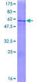 HSD17B11 Protein - 12.5% SDS-PAGE of human HSD17B11 stained with Coomassie Blue