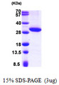 HSD17B11 Protein