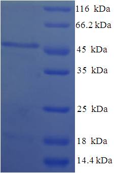 HSD17B11 Protein