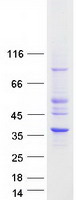 HSD17B11 Protein - Purified recombinant protein HSD17B11 was analyzed by SDS-PAGE gel and Coomassie Blue Staining