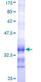 HSD17B12 Protein - 12.5% SDS-PAGE Stained with Coomassie Blue.