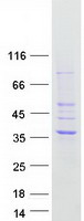 HSD17B13 Protein - Purified recombinant protein HSD17B13 was analyzed by SDS-PAGE gel and Coomassie Blue Staining