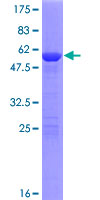 HSD17B14 Protein - 12.5% SDS-PAGE of human HSD17B14 stained with Coomassie Blue