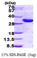 HSD17B14 Protein