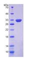 HSD17B14 Protein - Recombinant  17-Beta-Hydroxysteroid Dehydrogenase Type 14 By SDS-PAGE