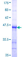 HSD17B2 Protein - 12.5% SDS-PAGE Stained with Coomassie Blue.