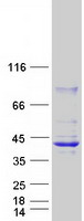 HSD17B2 Protein - Purified recombinant protein HSD17B2 was analyzed by SDS-PAGE gel and Coomassie Blue Staining