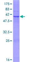 HSD17B3 Protein - 12.5% SDS-PAGE of human HSD17B3 stained with Coomassie Blue