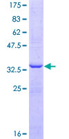 HSD17B3 Protein - 12.5% SDS-PAGE Stained with Coomassie Blue.