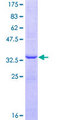 HSD17B3 Protein - 12.5% SDS-PAGE Stained with Coomassie Blue.