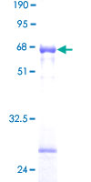 HSD17B6 Protein - 12.5% SDS-PAGE of human HSD17B6 stained with Coomassie Blue