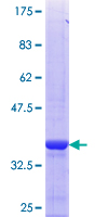 HSD17B6 Protein - 12.5% SDS-PAGE Stained with Coomassie Blue.